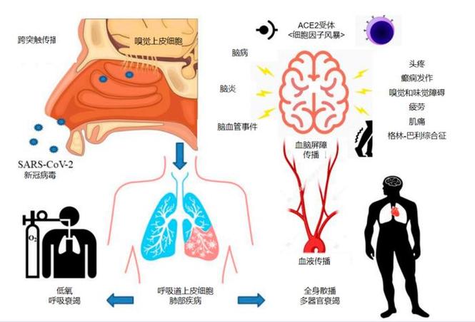 新冠疫情表现/新冠疫情表现症状-第2张图片