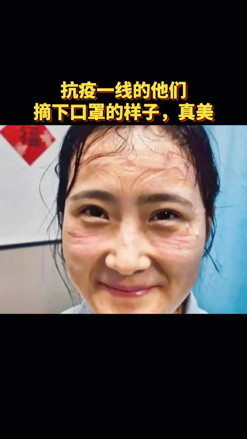 关于“疫情医生脸上”你不知道的事-第4张图片 关于“疫情医生脸上”你不知道的事-第4张图片