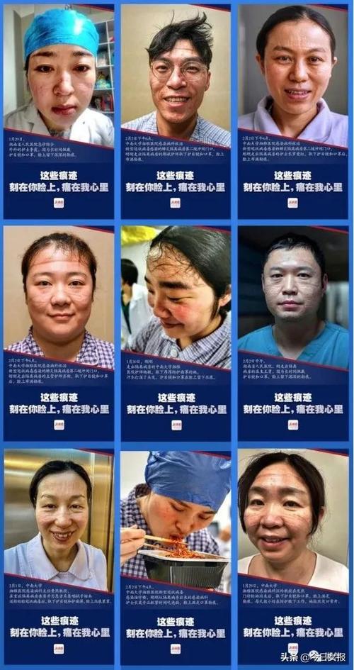 湖南是疫情区-湖南是疫情风险地区吗-第3张图片