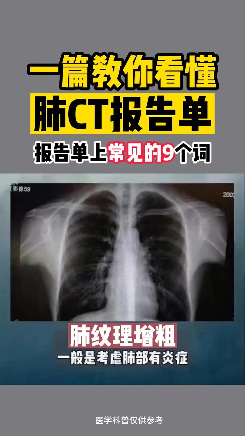 疫情恐慌调查-疫情恐慌的危害-第4张图片 疫情恐慌调查-疫情恐慌的危害-第4张图片