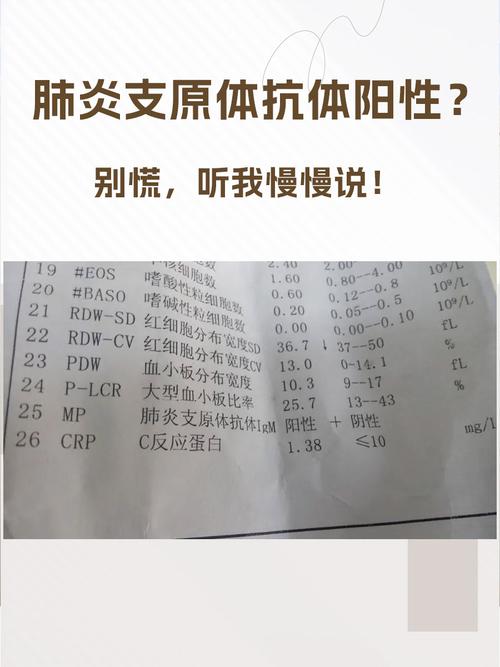 关于“疫情现感染”你不知道的事-第7张图片 关于“疫情现感染”你不知道的事-第7张图片