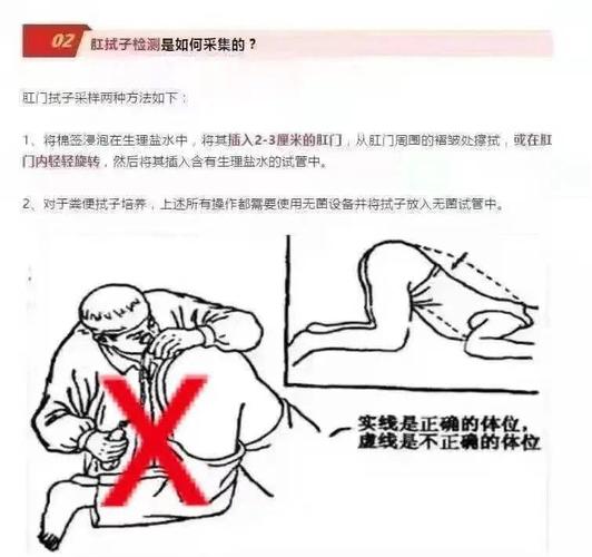 疫情标本检测-新冠疫情标本采集及核酸检测要点-第2张图片 疫情标本检测-新冠疫情标本采集及核酸检测要点-第2张图片