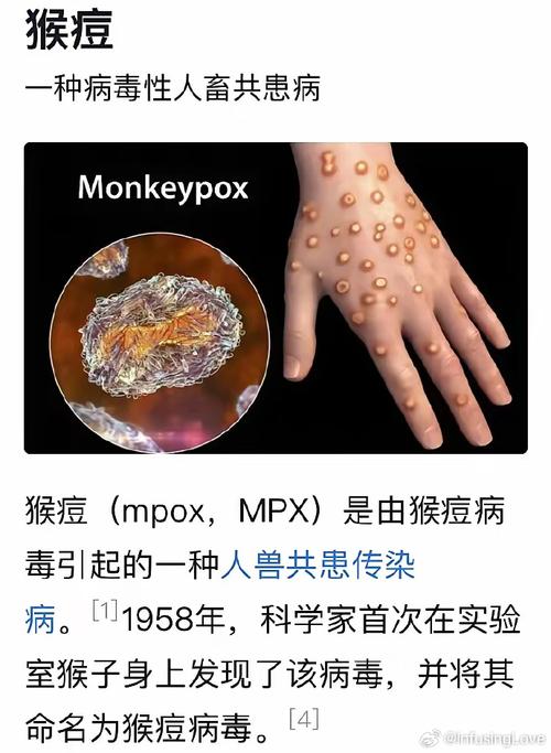 西班牙国疫情数据-西班牙疫情实时动态-第5张图片
