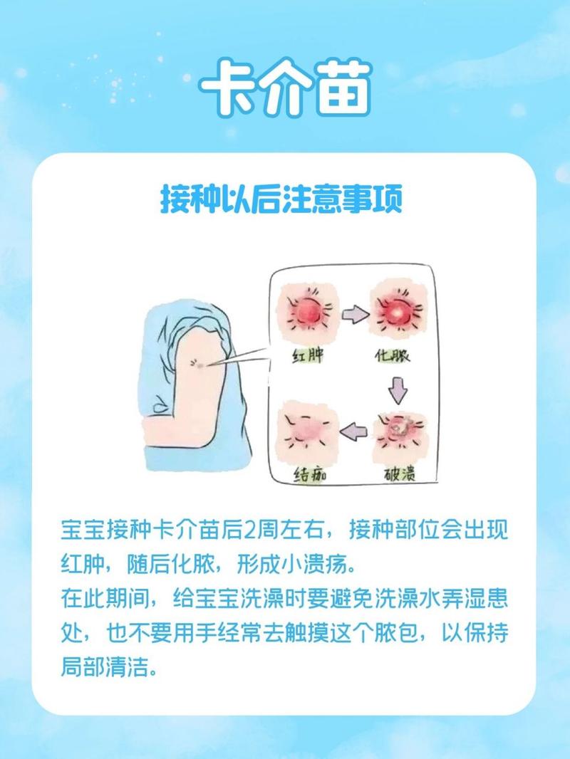 卡介苗疫情/卡介疫苗接种