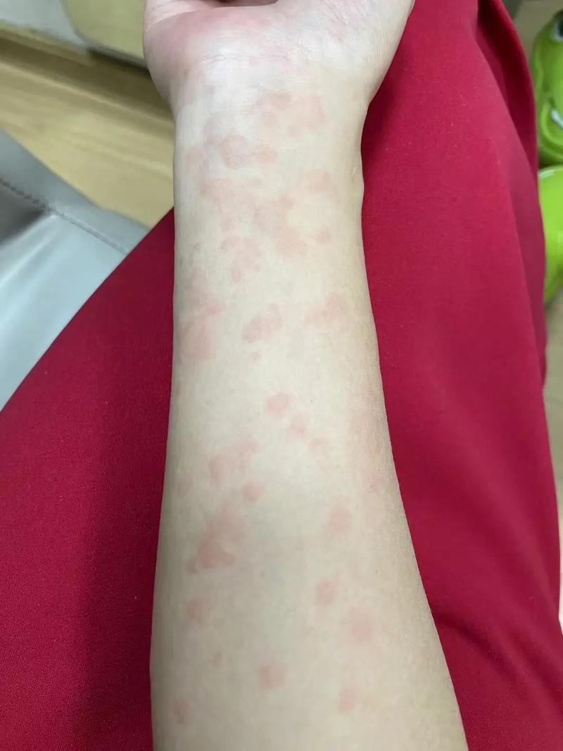 印度黑水鬼阿伐那非说明书-第8张图片 印度黑水鬼阿伐那非说明书-第8张图片
