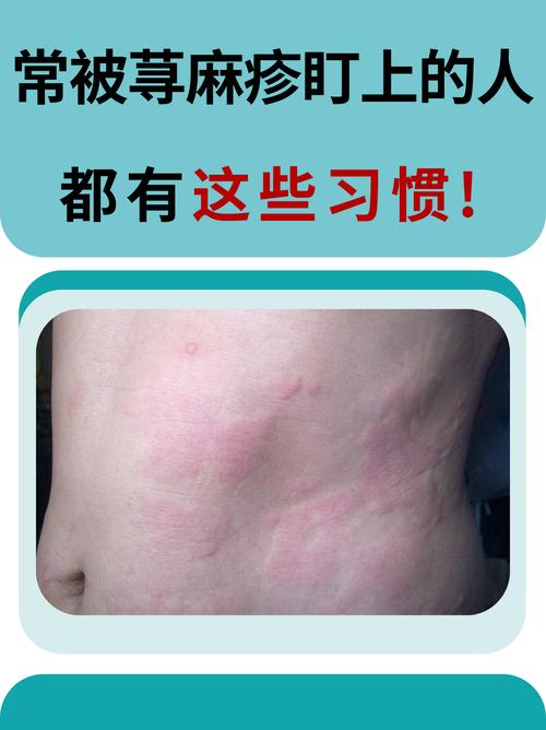 哪种天气适合过敏者出行，过敏性体质哪个季节容易过敏?-第10张图片