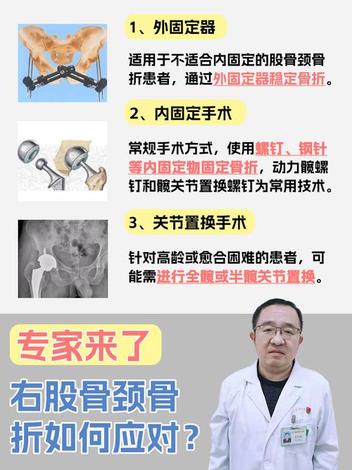 股骨骨折怎么出行，股骨骨折处理-第2张图片